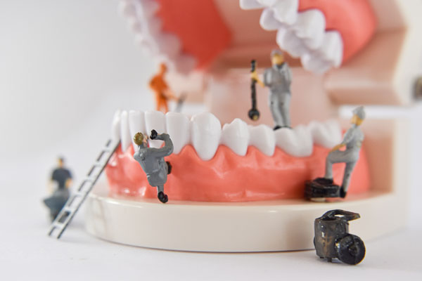 Επισκευές οδοντοστοιχιών – Rebase και Denture Reline